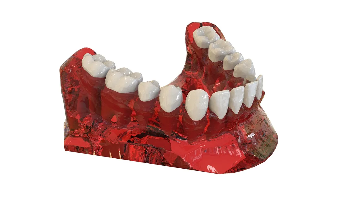 Dental Implants: The Complete Guide Before You Decide